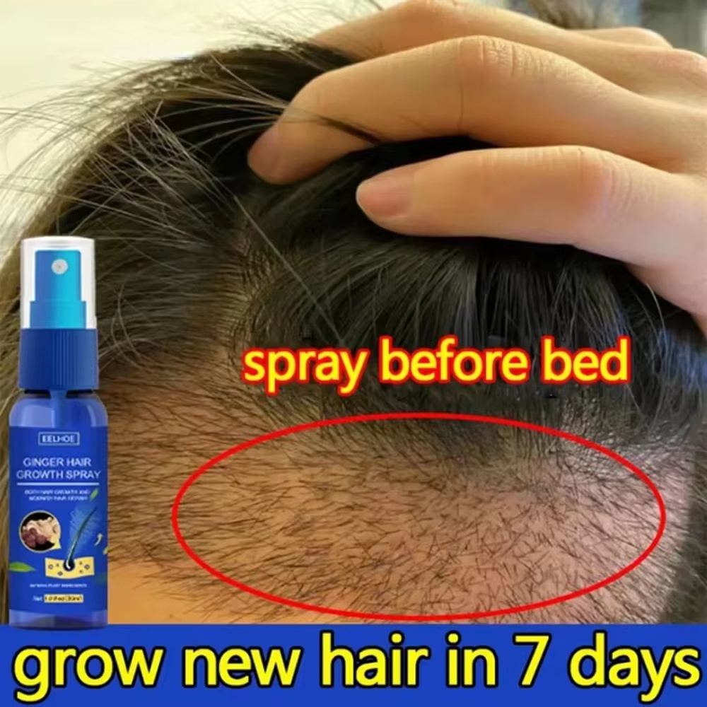 สเปรย์เร่งผมยาวขึ้นอย่างรวดเร็ - Hair Care Lotion บทวิจารณ์และราคา